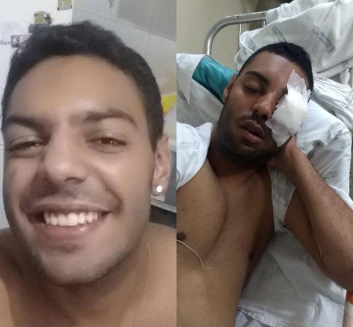 Jovem perde a visão depois de ser atingido por tiro de borracha disparado por policial militar em Montes Claros