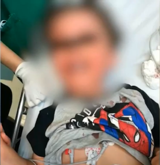 Desespero: vidro cede e menino de 3 anos cai de 5 metros de altura