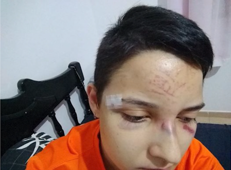 Covardia: mulheres são agredidas em assalto