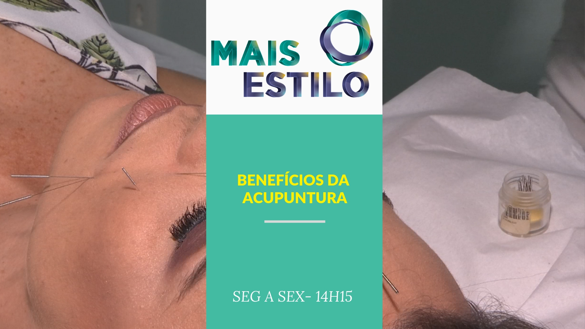 Angélica Hodge passa pelo procedimento de acupuntura