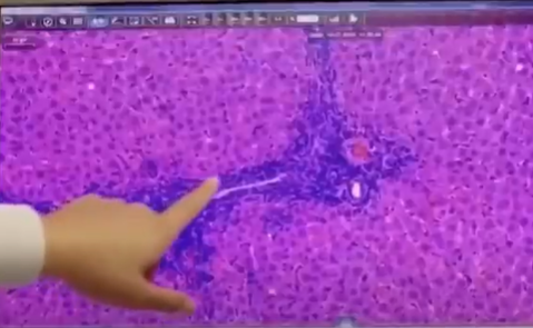 Covid-19: 4 possíveis vacinas estão em fases adiantadas nos testes