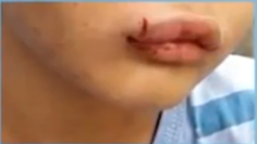 Polícia abre inquérito para apurar caso de menino que teria sido agredido pela mãe e pelo padrasto