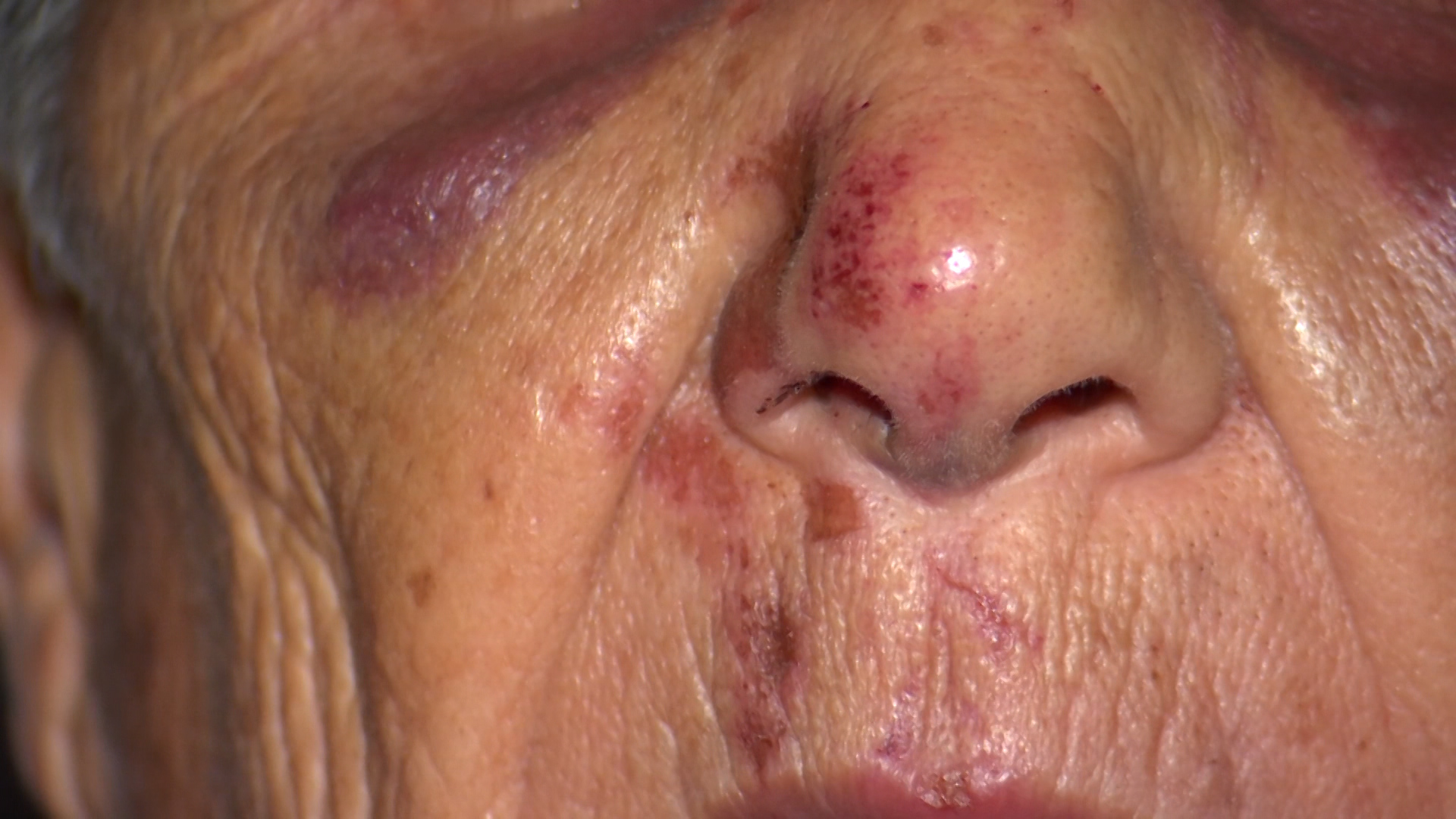 Três Pontas: idosa quebra o nariz durante assalto