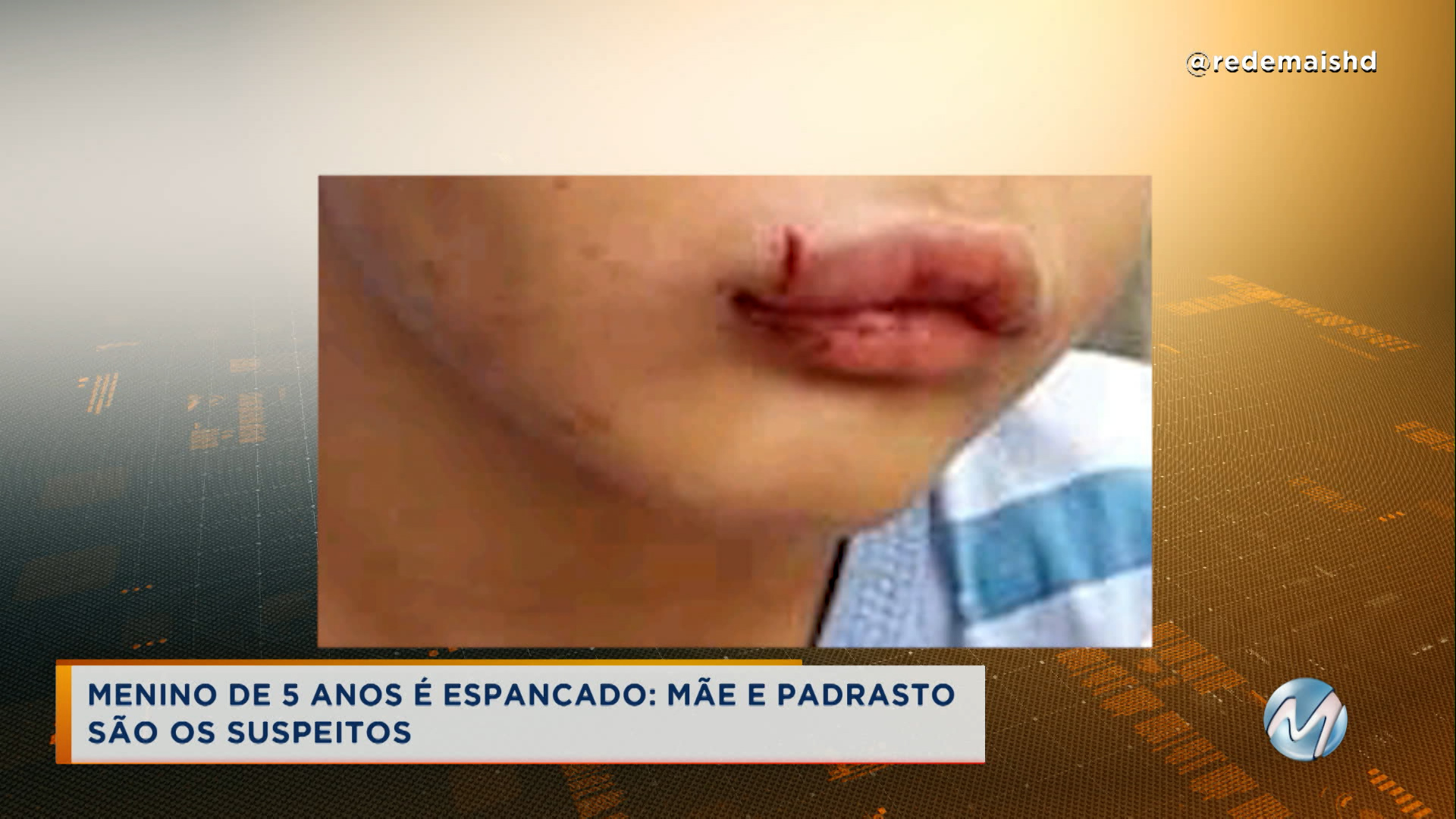 Mãe é presa e padrasto apreendido suspeitos de espancar menino de 5 anos