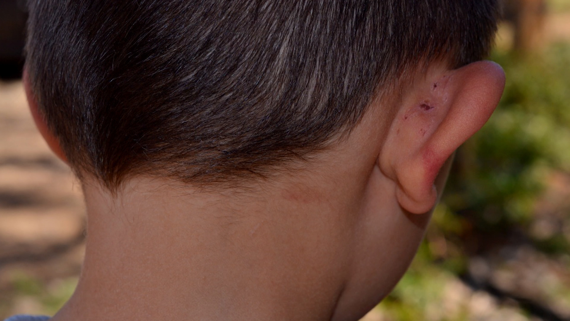 Pai denuncia que filho estaria sendo agredido