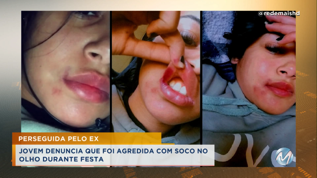 Jovem denuncia que foi agredida com um soco pelo ex-namorado