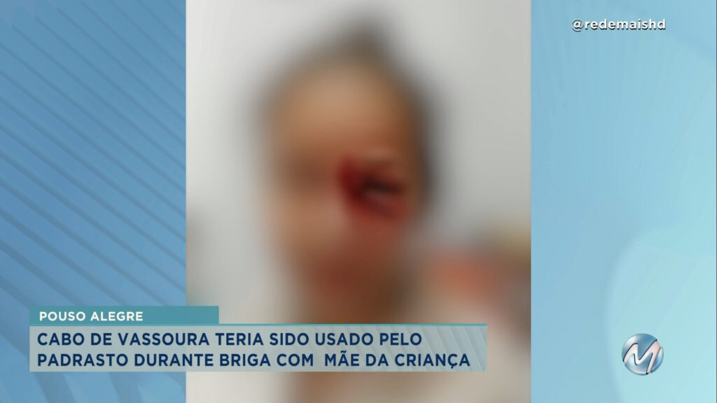 Pouso Alegre: criança de 5 anos fica ferida durante briga entre mãe e padrasto