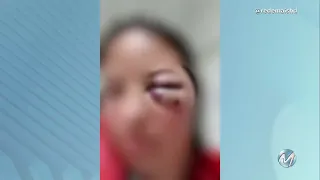Mulher baleada pelo namorado passa por cirurgia em Alfenas