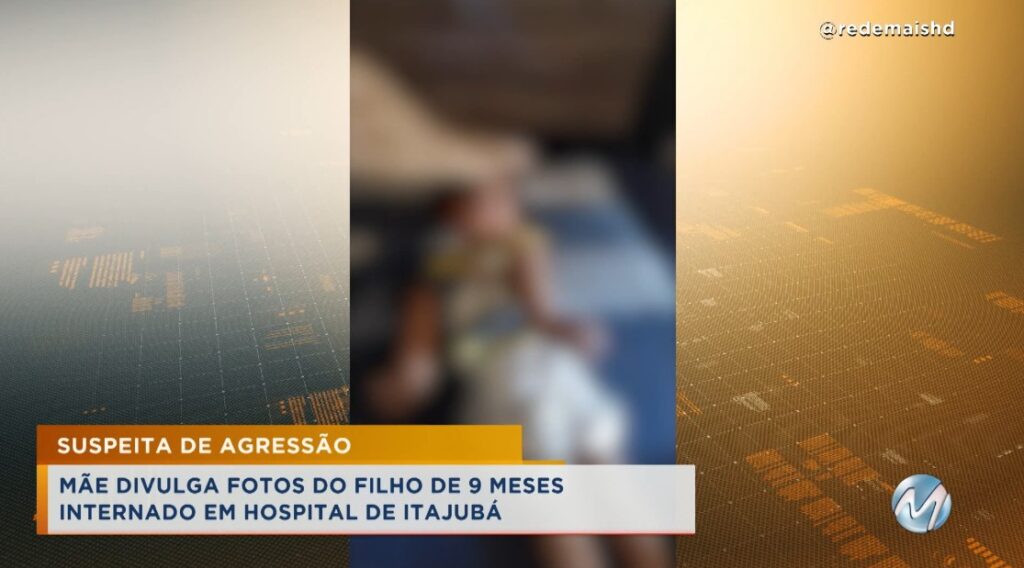 Polícia investiga o caso: Mãe divulga imagens de bebê de 9 meses que está internado em Itajubá