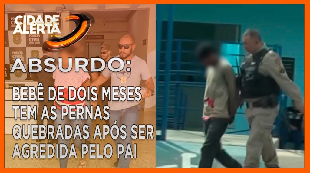 ABSURDO: BEBÊ DE DOIS MESES TEM AS PERNAS QUEBRADAS APÓS SER AGREDIDA PELO PAI