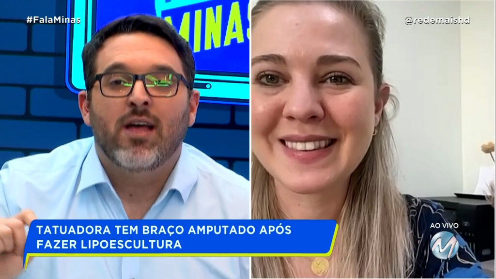 TATUADORA TEM BRAÇO AMPUTADO APÓS FAZER LIPOESCULTURA