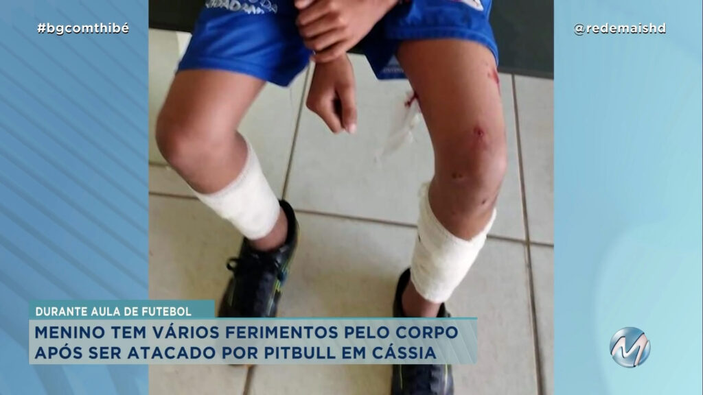 PITBULL ATACA GAROTO DE 9 ANOS EM CÁSSIA