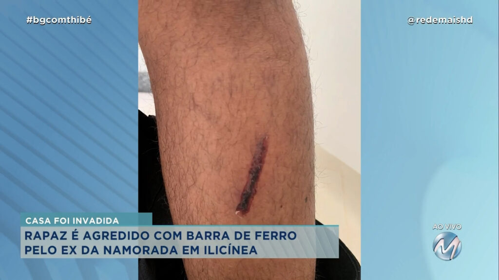 RAPAZ É AGREDIDO COM BARRA DE FERRO PELO EX DA NAMORADA EM ILICÍNEA