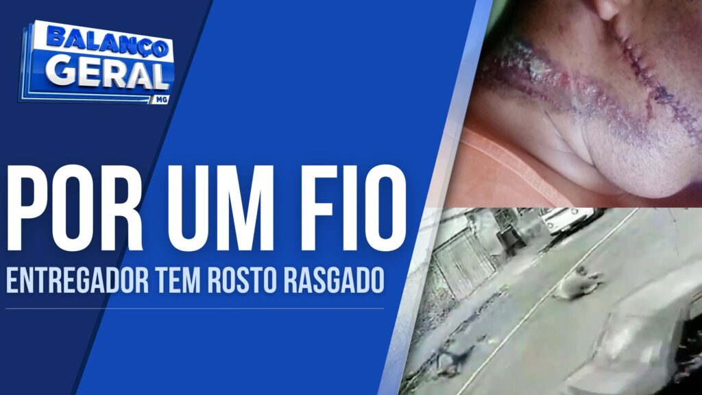 HOMEM LEVA 25 PONTOS NO ROSTO APÓS SER SURPREENDIDO POR FIO SOLTO DE POSTE EM JUIZ DE FORA