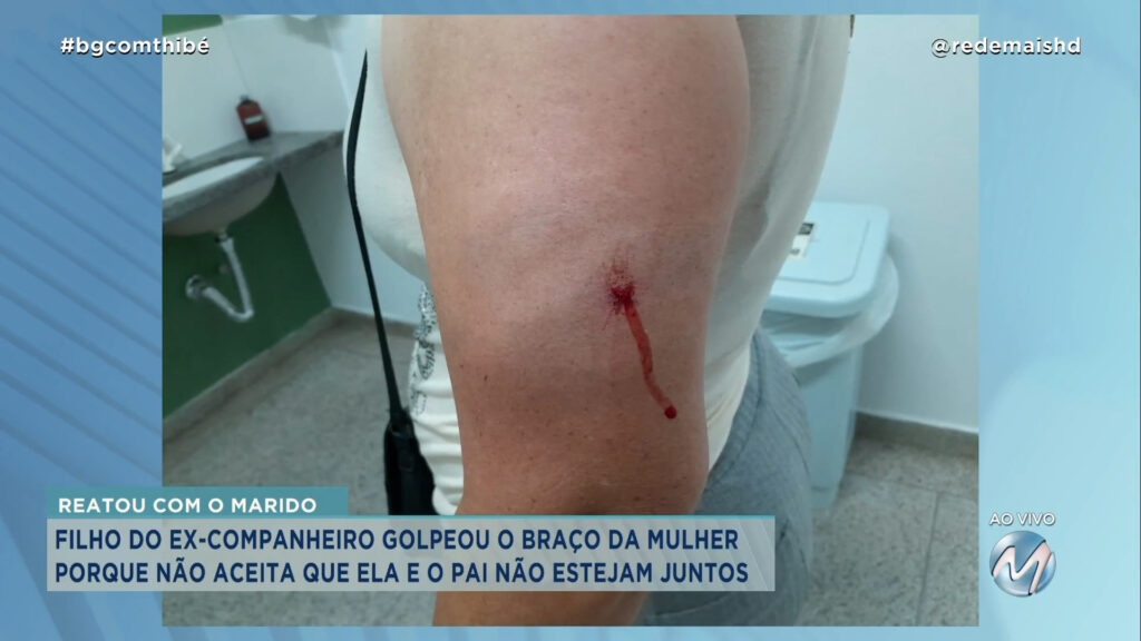 EM CAMPANHA: MULHER REATA CASAMENTO E É AGREDIDA COM BARRA DE FERRO PELO FILHO DO EX