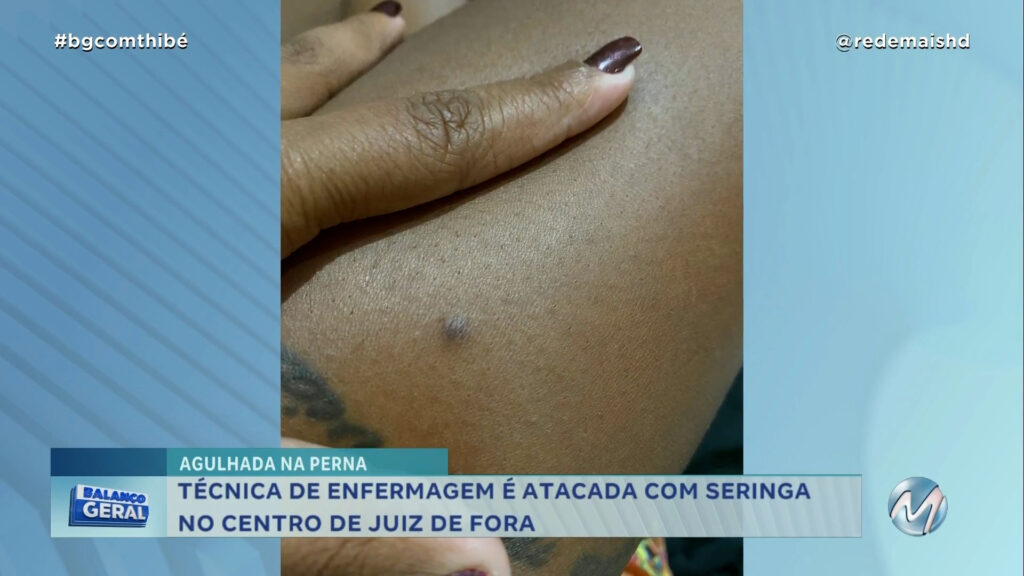 TÉCNICA DE ENFERMAGEM É ATACADA COM SERINGA NO CENTRO DE JUIZ DE FORA