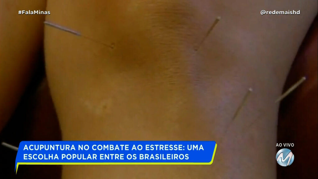 ACUPUNTURA: O SEGREDO DOS BRASILEIROS PARA VENCER O ESTRESSE PÓS-PANDEMIA!