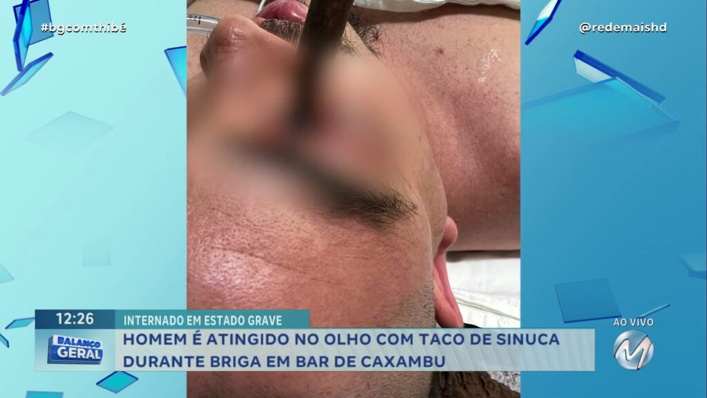 HOMEM ATINGIDO NO OLHO COM TACO DE SINUCA PODE PERDER OS MOVIMENTOS DE UM LADO DO CORPO