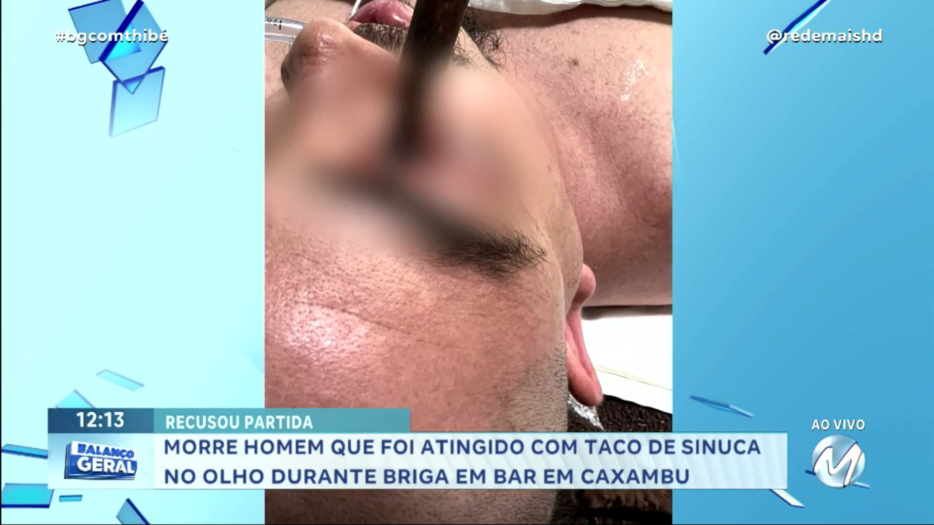 MORRE HOMEM QUE FOI ATINGIDO COM TACO DE SINUCA NO OLHO DURANTE BRIGA EM  BAR EM CAXAMBU | Rede Mais