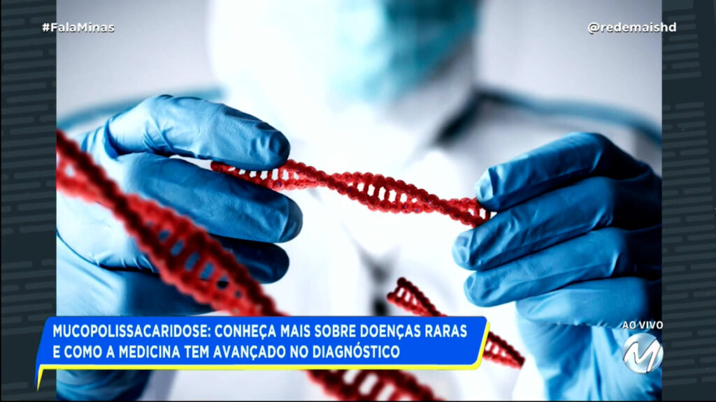 MUCOPOLISSACARIDOSE: CONHEÇA MAIS SOBRE DOENÇAS RARAS E COMO A MEDICINA TEM AVANÇADO NO DIAGNÓSTICO