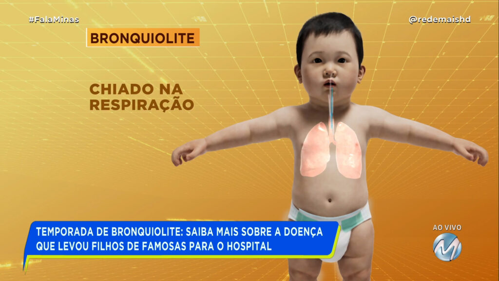 TEMPORADA DE BRONQUIOLITE: SAIBA MAIS SOBRE A DOENÇA QUE LEVOU FILHO DE FAMOSAS PARA O HOSPITAL