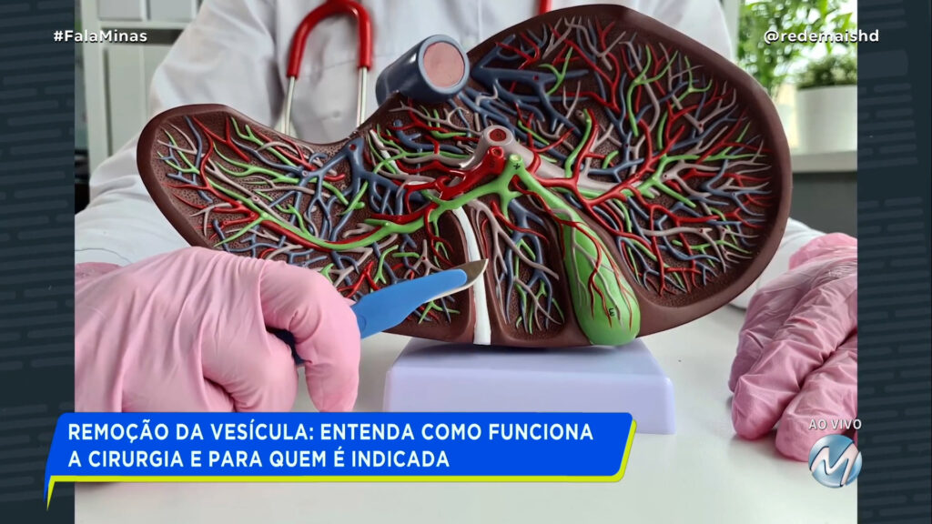 CIRURGIA DE VESÍCULA: SAIBA SOBRE PROCEDIMENTO QUE AFASTOU O CANTOR SERTANEJO CRISTIANO DOS PALCOS