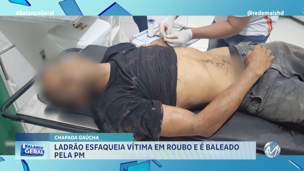 LADRÃO ESFAQUEIA VÍTIMA EM ROUBO E É BALEADO PELA PM