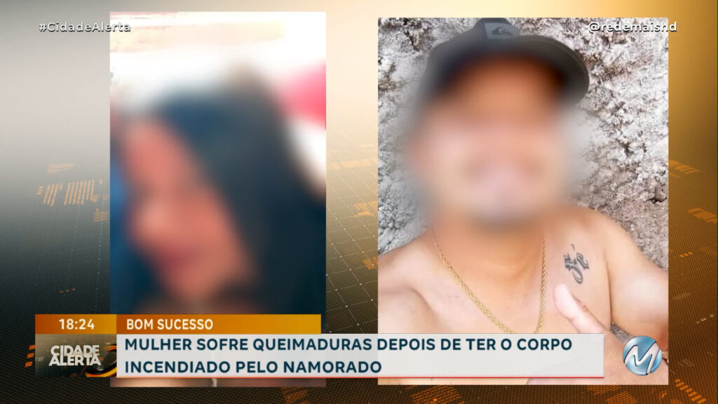 BOM SUCESSO: MULHER SOFRE QUEIMADURAS DEPOIS DE TER O CORPO INCENDIADO PELO NAMORADO