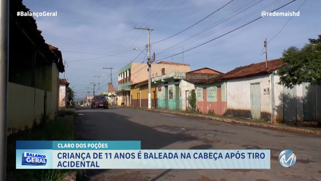 CRIANÇA DE 11 ANOS É BALEADA NA CABEÇA APÓS TIRO ACIDENTAL