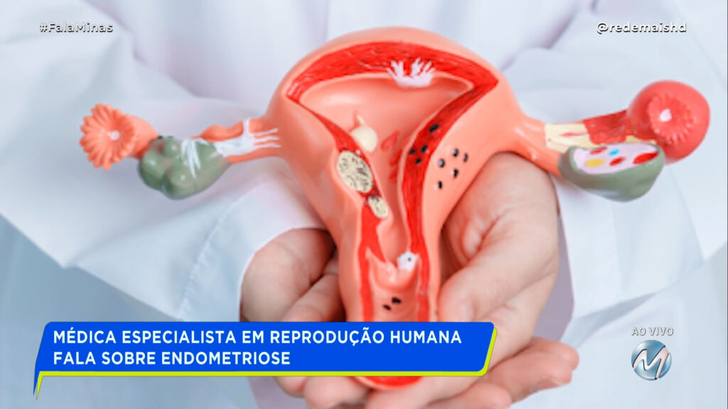 MÉDICA ESPECIALISTA EM REPRODUÇÃO HUMANA FALA SOBRE ENDOMETRIOSE