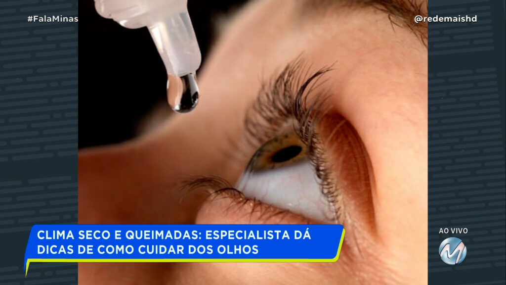 CLIMA SECO E QUEIMADAS: ESPECIALISTA DÁ DICAS DE COMO CUIDAR DOS OLHOS