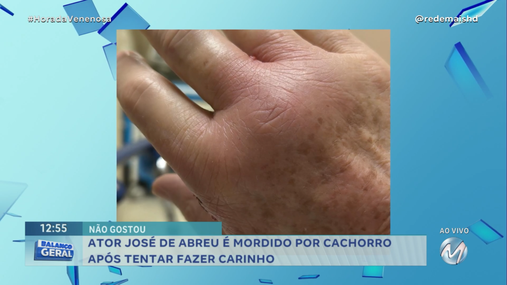 NÃO GOSTOU: ATOR JOSÉ DE ABREU É MORDIDO POR CACHORRO APÓS TENTAR FAZER CARINHO | HORA DA VENENOSA