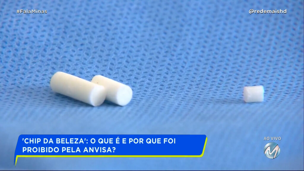 ‘CHIP DA BELEZA’: O QUE É E POR QUE FOI PROIBIDO PELA ANVISA?