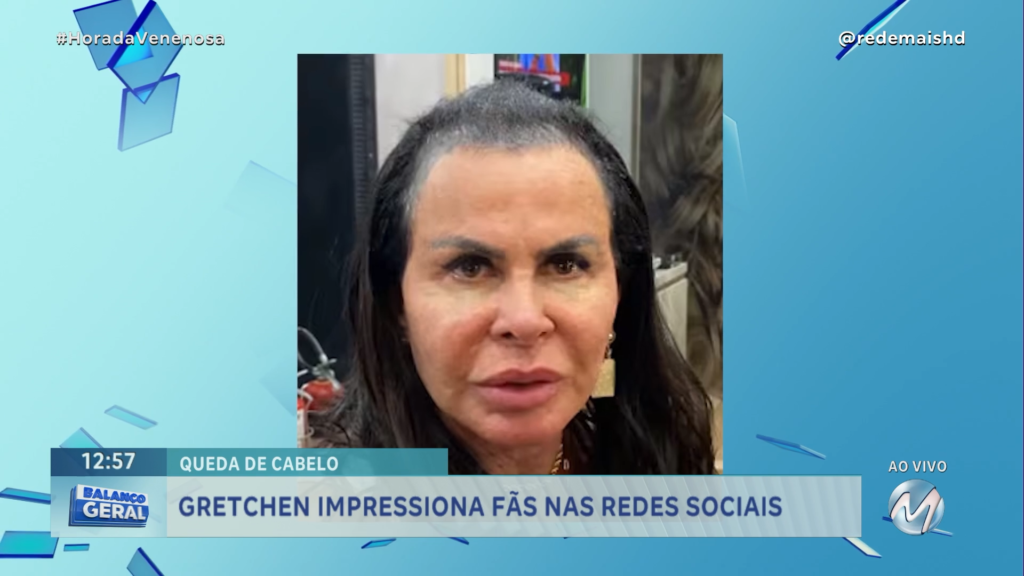 GRETCHEN REVELA VERDADE SOBRE CALVÍCIE E SURPREENDE FÃS | HORA DA VENENOSA