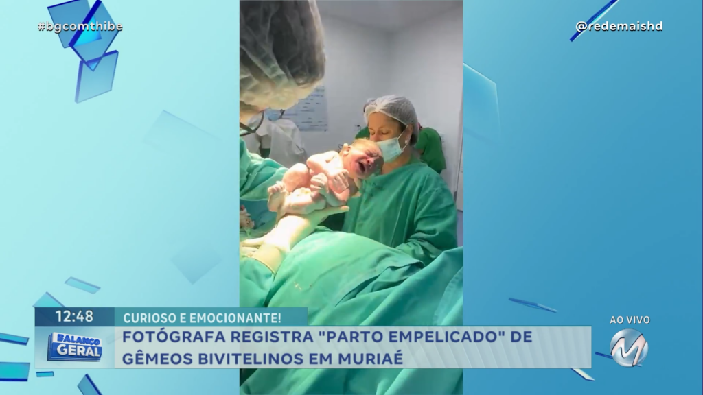 FOTÓGRAFA REGISTRA “PARTO EMPELICADO” DE GÊMEOS BIVITELINOS EM MURIAÉ