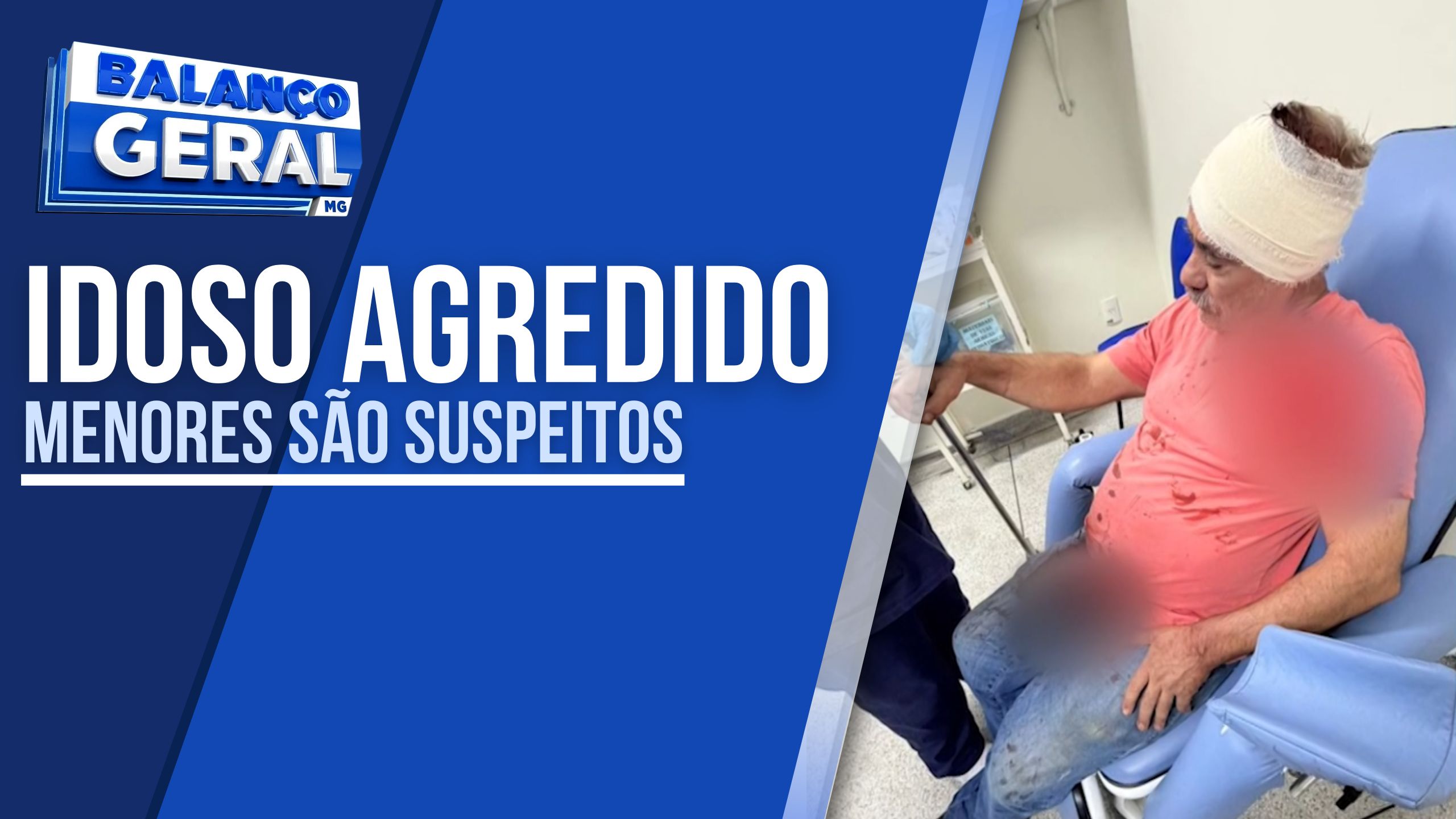 BRUTALIDADE: FAMÍLIA PEDE JUSTIÇA APÓS IDOSO SER AGREDIDO A PEDRADAS NA MADRUGADA DE DOMINGO EM LAVRAS