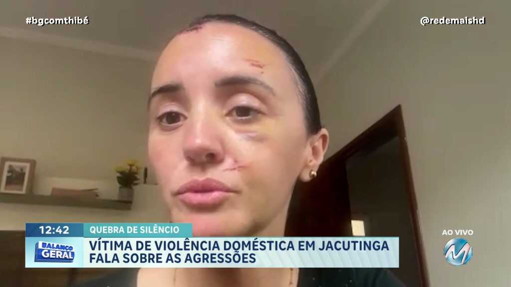 QUEBROU O SILÊNCIO: MULHER QUE TEVE TRAUMATISMO CRANIANO APÓS AGRESSÃO DO COMPANHEIRO FALOU COM O BALANÇO GERAL