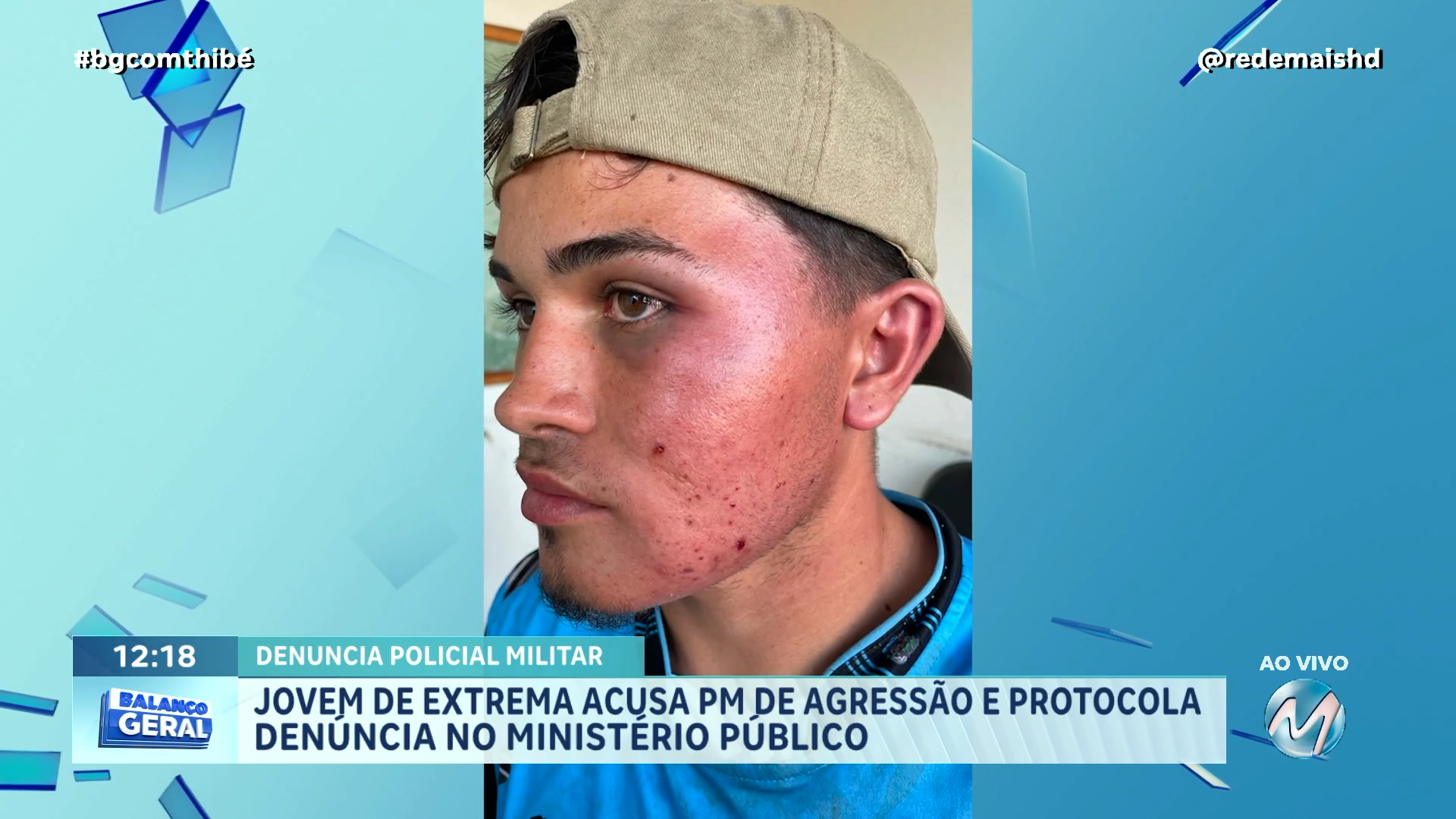 DENÚNCIA POLICIAL : JOVEM ACUSA PM DE AGRESSÃO EM EXTREMA