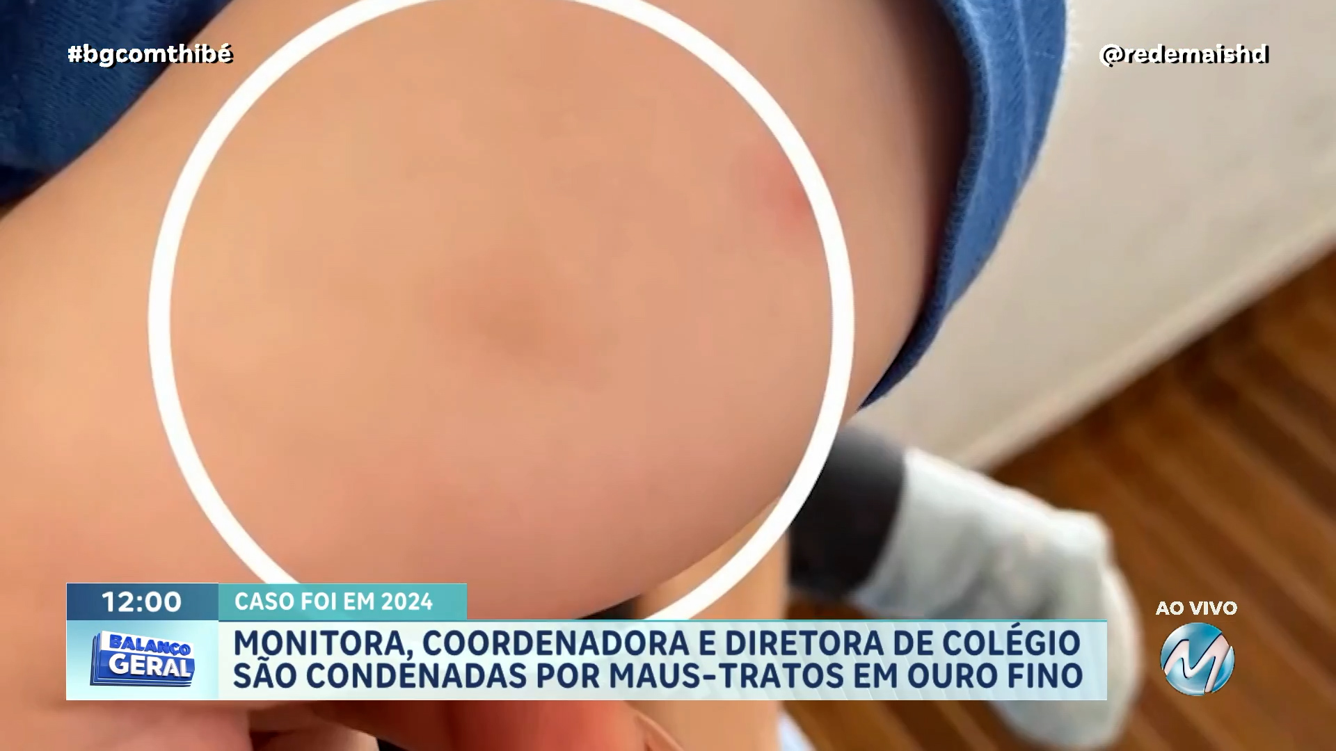 DIRETORA, COORDENADORA E MONITORA SÃO CONDENADAS APÓS CASO DE BEBÊ TORTURADO DE BERÇÁRIO EM OURO FINO
