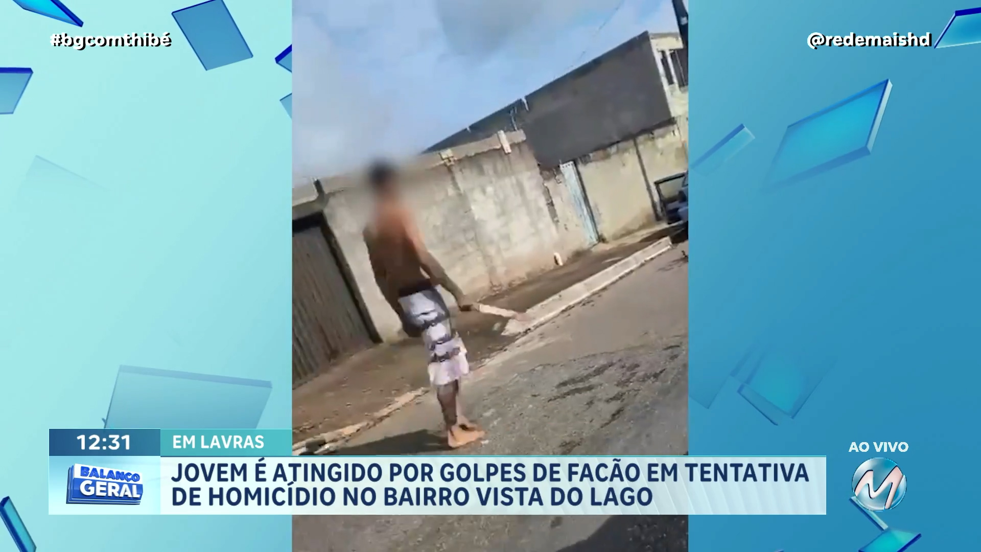 JOVEM DE 18 ANOS É AGREDIDO COM GOLPES DE FACÃO APÓS BRIGA EM LAVRAS